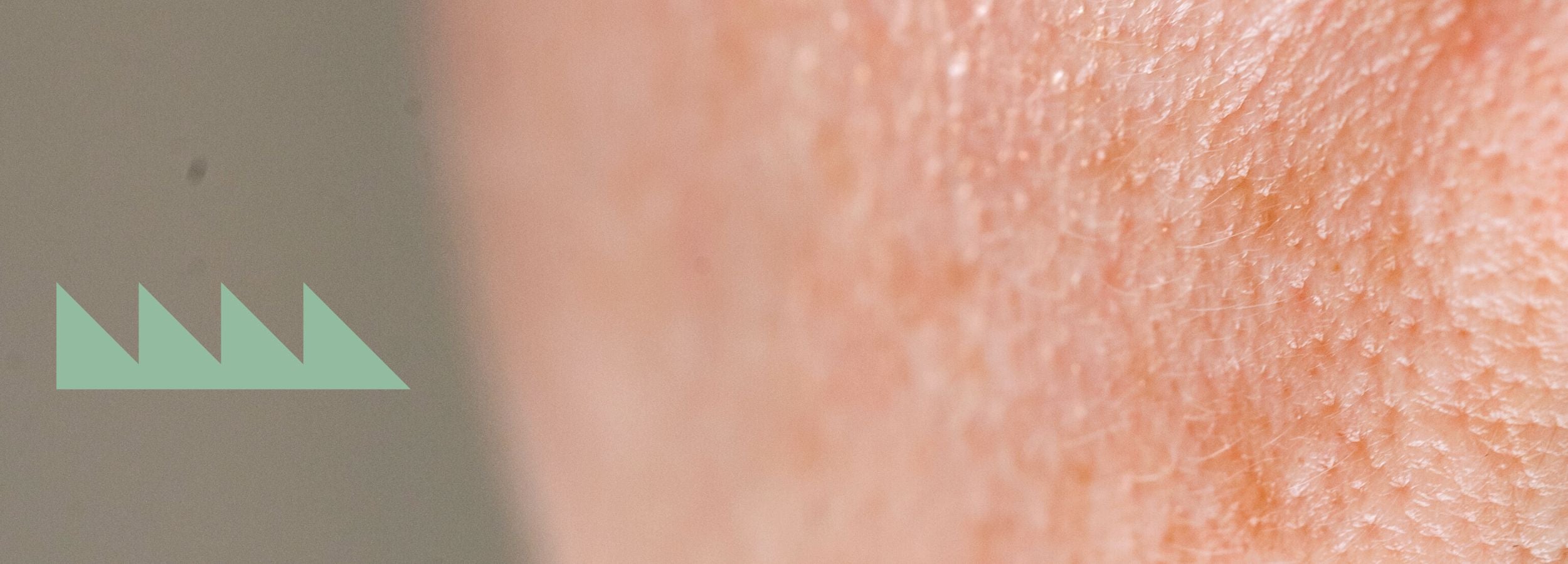 Synlige porer - Sara Lorentsen Skin Expert